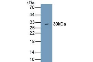 Detection of Recombinant WDR90, Human using Polyclonal Antibody to WD Repeat Containing Domain Protein 90 (WDR90) (WDR90 antibody  (AA 1-235))