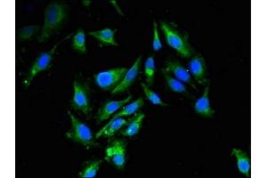 Immunofluorescent analysis of Hela cells using ABIN7151111 at dilution of 1:100 and Alexa Fluor 488-congugated AffiniPure Goat Anti-Rabbit IgG(H+L) (RBBP6 antibody  (AA 51-97))