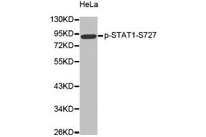 Western Blotting (WB) image for anti-Signal Transducer and Activator of Transcription 1, 91kDa (STAT1) (pSer727) antibody (ABIN1870637) (STAT1 antibody  (pSer727))