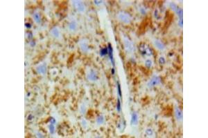 Used in DAB staining on fromalin fixed paraffin-embedded Brain tissue (DVL2 antibody  (AA 78-250))