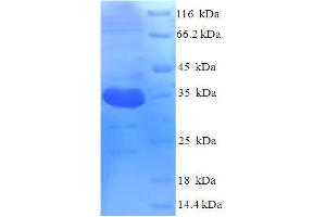 FCGBP Protein (AA 1-183, full length) (His-SUMO Tag)
