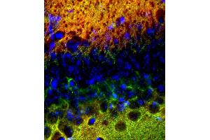 Immunohistochemistry (IHC) image for anti-SynCAM 1/2/3 (AA 436-446) antibody (ABIN1742491) (SynCAM 1/2/3 (AA 436-446) antibody)