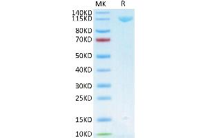 Human Her3 on Tris-Bis PAGE under reduced conditions. (ERBB3 Protein (AA 20-643) (Fc Tag))