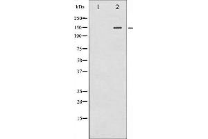 Western blot analysis of iNOS phosphorylation expression in whole cell lysates,The lane on the left is treated with the antigen-specific peptide. (NOS2 antibody  (pTyr151))