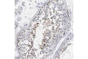 Immunohistochemical staining of human testis with C9orf11 polyclonal antibody  shows strong cytoplasmic positivity in a subset of seminiferus duct cells.