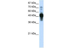 Transfected 293T; WB Suggested Anti-ZNF342 Antibody Titration: 0.