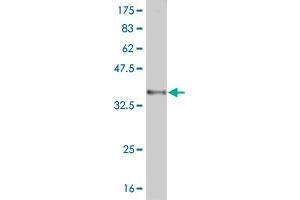 Western Blot detection against Immunogen (36. (RNF122 antibody  (AA 61-155))