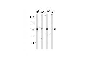 All lanes : Anti-BRAF Antibody  at 1:500-2000 dilution Lane 1: K562 whole cell lysate Lane 2: Raji whole cell lysate Lane 3: T47D whole cell lysate Lane 4: A20 whole cell lysate Lysates/proteins at 20 μg per lane. (BRAF antibody  (AA 379-408))