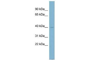NDUFA9 antibody used at 1 ug/ml to detect target protein. (NDUFA9 antibody)