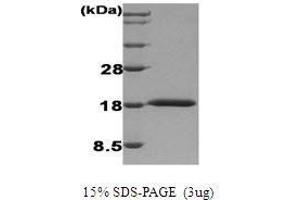 Figure annotation denotes ug of protein loaded and % gel used. (IFNA1 Protein)
