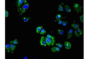Immunofluorescent analysis of MCF-7 cells using ABIN7145429 at dilution of 1:100 and Alexa Fluor 488-congugated AffiniPure Goat Anti-Rabbit IgG(H+L) (ADRB3 antibody  (AA 1-36))