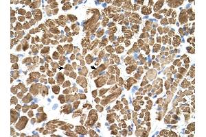 Tropomyosin 2 antibody was used for immunohistochemistry at a concentration of 4-8 ug/ml to stain Skeletal muscle cells (arrows) in Human Muscle. (TPM2 antibody)