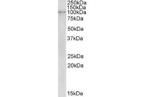 ABIN571135 (2µg/ml) staining of Human Breast cancer lysate (35µg protein in RIPA buffer). (NLRX1 antibody  (Internal Region))