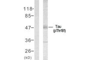Western blot analysis of extracts from mouse brain, using Tau (Phospho-Thr181) Antibody. (tau antibody  (pThr498))