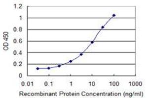 Detection limit for recombinant GST tagged MYL6B is 0. (MYL6B antibody  (AA 109-208))