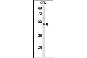 Western blot analysis in CEM cerebellum cell line lysates (35 ug/lane) using SLC39A8 Antibody (Center) Cat. (SLC39A8 antibody  (Middle Region))