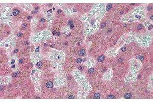 Immunohistochemistry (IHC) image for anti-Ceruloplasmin (Ferroxidase) (CP) (AA 789-1065) antibody (ABIN7426115)
