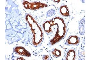 Image no. 2 for anti-Keratin 18 (KRT18) antibody (ABIN6179389) (Cytokeratin 18 antibody)