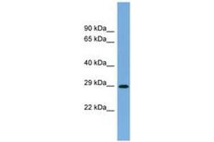 Image no. 1 for anti-RAB40C, Member RAS Oncogene Family (RAB40C) (AA 35-84) antibody (ABIN6743281) (RAB40C antibody  (AA 35-84))