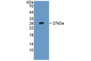 Detection of Recombinant RPL23A, Human using Polyclonal Antibody to Ribosomal Protein L23A (RPL23A) (RPL23A antibody  (AA 2-156))