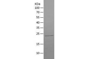 Western Blotting (WB) image for YEATS Domain Containing 2 (YEATS2) (AA 188-355) protein (His tag) (ABIN7282825) (YEATS2 Protein (AA 188-355) (His tag))