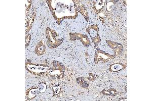 IHC analysis of TTLL2 using anti-TTLL2 antibody (ABIN7600850). (TTLL2 antibody  (AA 24-582))