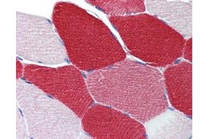 anti-Myosin Light Chain 6, Alkali, Smooth Muscle and Non Muscle (MYL6) (N-Term) antibody