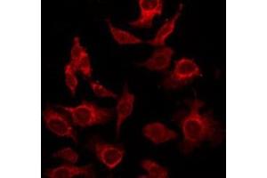 ABIN6276397 staining HepG2 by IF/ICC. (Interleukin 17a antibody  (Internal Region))