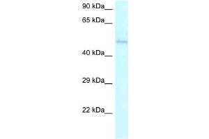Western Blot showing AMBN antibody used at a concentration of 1 ug/ml against Jurkat Cell Lysate (AMBN antibody  (C-Term))