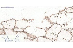Immunohistochemistry of paraffin-embedded Human lung tissue using Desmin Monoclonal Antibody at dilution of 1:200. (Desmin antibody)