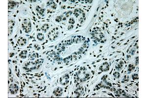 Immunohistochemical staining of paraffin-embedded breast tissue using anti-GAD1 mouse monoclonal antibody. (GAD antibody)