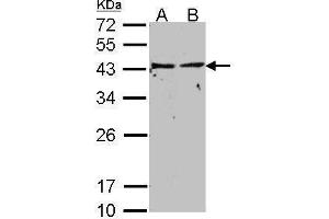 WB Image Sample(30 ug whole cell lysate) A: A431, B: HeLa S3, 12% SDS PAGE antibody diluted at 1:500 (GNAI1 antibody  (Center))