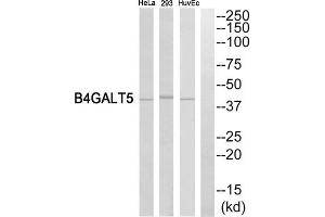 Western blot analysis of extracts from HeLa cells, HuvEc cells and 293 cells, using B4GALT5 antibody. (B4GALT5 antibody  (C-Term))
