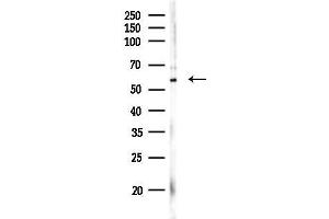 anti-Interferon-Induced Protein with Tetratricopeptide Repeats 2 (IFIT2) (Internal Region) antibody