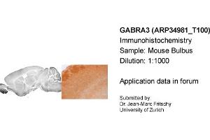 Immunohistochemistry (IHC) image for anti-gamma-aminobutyric Acid (GABA) A Receptor, alpha 3 (GABRA3) (Middle Region) antibody (ABIN183120) (GABRA3 antibody  (Middle Region))