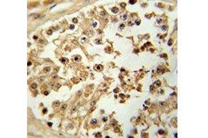 Immunohistochemistry (IHC) image for anti-Eukaryotic Translation Initiation Factor 4E (EIF4E) antibody (ABIN3030891)
