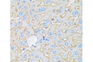 Immunohistochemistry of paraffin-embedded Mouse liver using ASGR1 Polyclonal Antibody at dilution of 1:100 (40x lens). (Asialoglycoprotein Receptor 1 antibody)