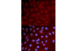 Immunofluorescence analysis of U2OS cell using IRF3 antibody. (IRF3 antibody)