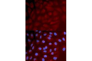 Immunofluorescence analysis of U2OS cell using IRF3 antibody. (IRF3 antibody)