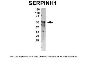 IP Suggested Anti-SERPINH1 Antibody Positive Control: NT2 CELL/BRAIN TISSUE (SERPINH1 antibody  (C-Term))