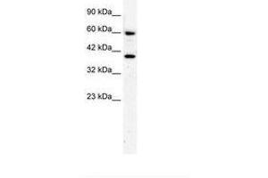 Image no. 2 for anti-RAR-Related Orphan Receptor A (RORA) (AA 50-99) antibody (ABIN202757) (RORA antibody  (AA 50-99))