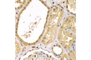 Immunohistochemistry of paraffin-embedded human kidney using XIAP antibody (ABIN5974139) at dilution of 1/100 (40x lens). (XIAP antibody)