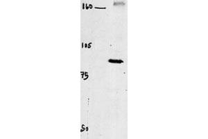 Western blot of chicken brain tissue incubated with CLC4 Antibody (C-term). (CLCN4 antibody  (C-Term))