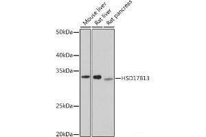Western blot analysis of extracts of various cell lines using HSD17B13 Polyclonal Antibody at dilution of 1:1000.