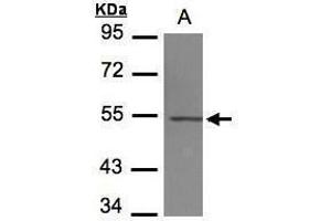 WB Image Sample(30 μg of whole cell lysate) A:293T 7. (TUBB4 antibody)