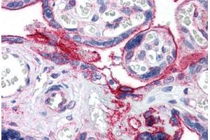 Human Placenta: Formalin-Fixed, Paraffin-Embedded (FFPE) (ITGB1 antibody  (Subunit 1 beta) (FITC))