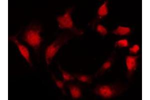 Immunofluorescence (fixed cells) (IF/ICC) image for anti-Histone Deacetylase 6 (HDAC6) (N-Term) antibody (ABIN6262187)