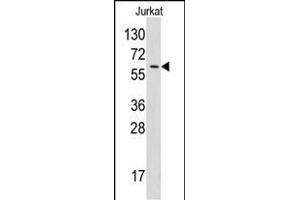 Western blot analysis of anti-YARS Pab (ABIN391838 and ABIN2841677) in Jurkat cell line lysates (35 μg/lane). (YARS antibody  (N-Term))
