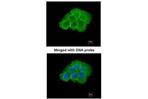 Immunofluorescence (IF) image for anti-Mitogen-Activated Protein Kinase Kinase Kinase Kinase 5 (MAP4K5) antibody (ABIN2856668)