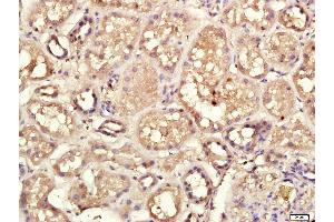 Paraformaldehyde-fixed, paraffin embedded Human kidney, Antigen retrieval by boiling in sodium citrate buffer (pH6. (CECR1 antibody  (AA 450-500))